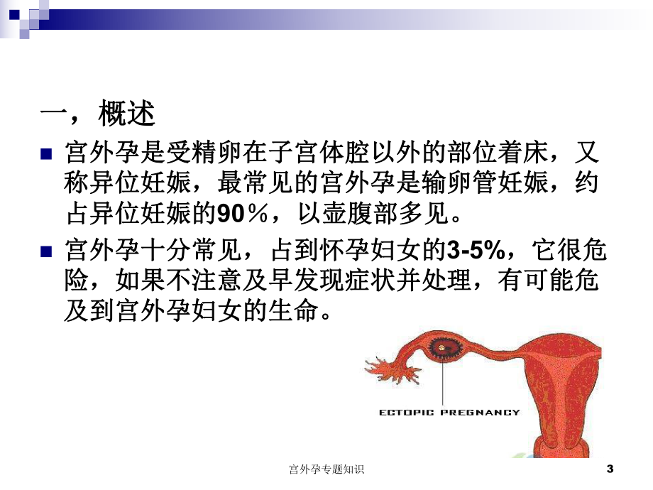 宫外孕专题知识培训课件.ppt_第3页