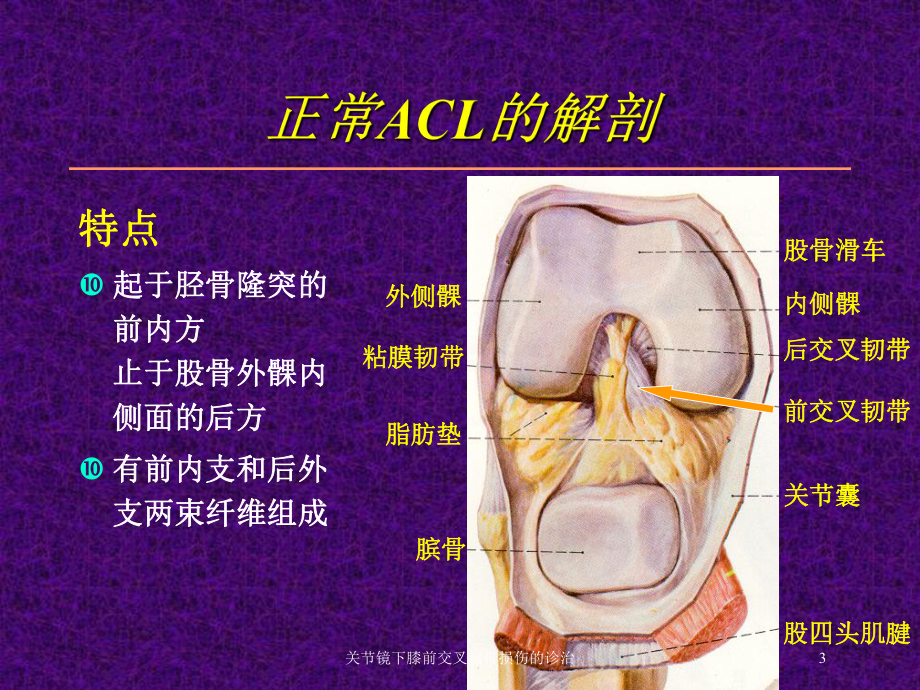 关节镜下膝前交叉韧带损伤的诊治培训课件.ppt_第3页