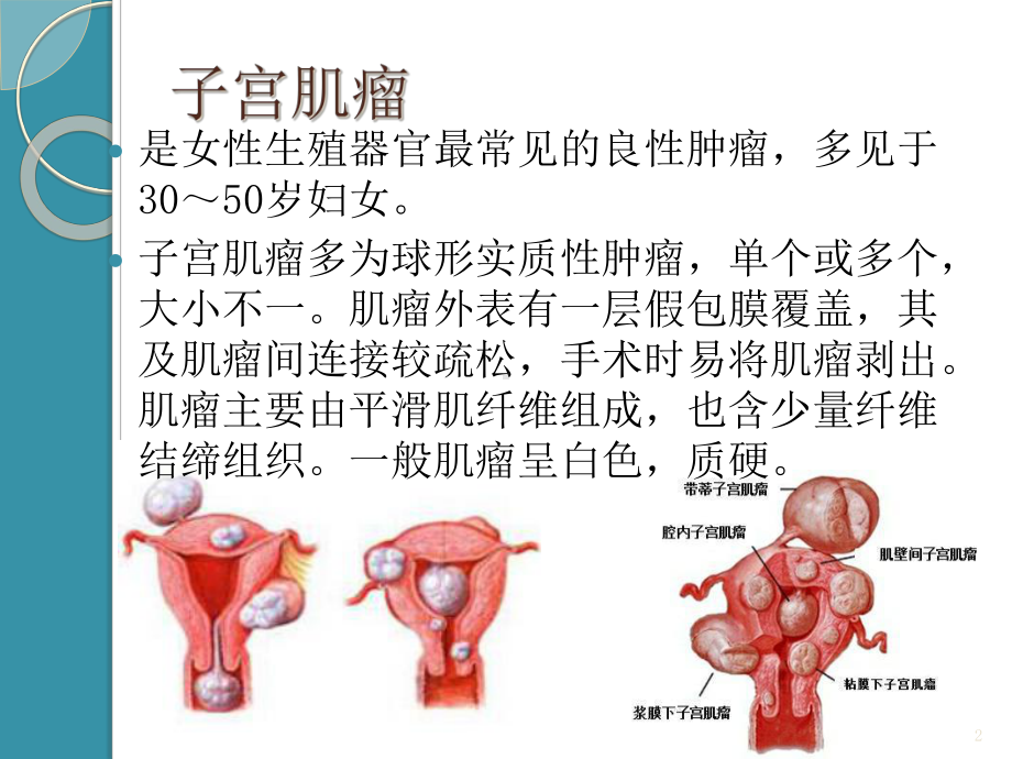 妇科常见疾病的临床特点课件.ppt_第2页