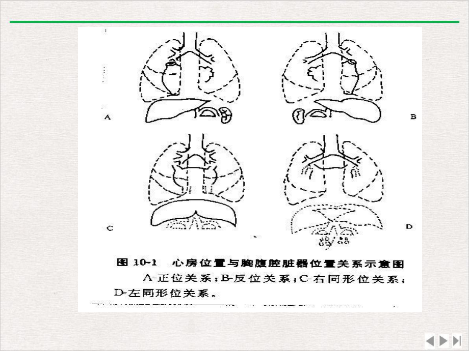 前辈复杂先心病超声诊断基本概念课件完整版.ppt_第3页