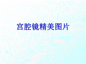 宫腔镜精美图片培训课件-2.ppt