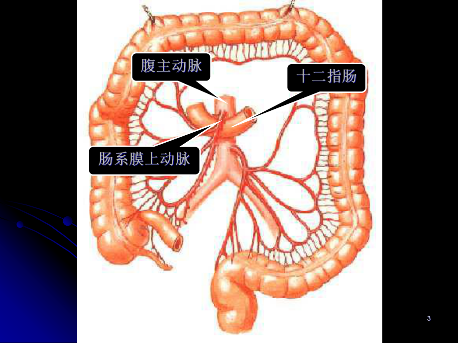 十二指肠淤积症课件.pptx_第3页