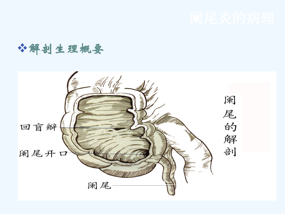 小儿阑尾炎围手术期护理课件.ppt_第3页