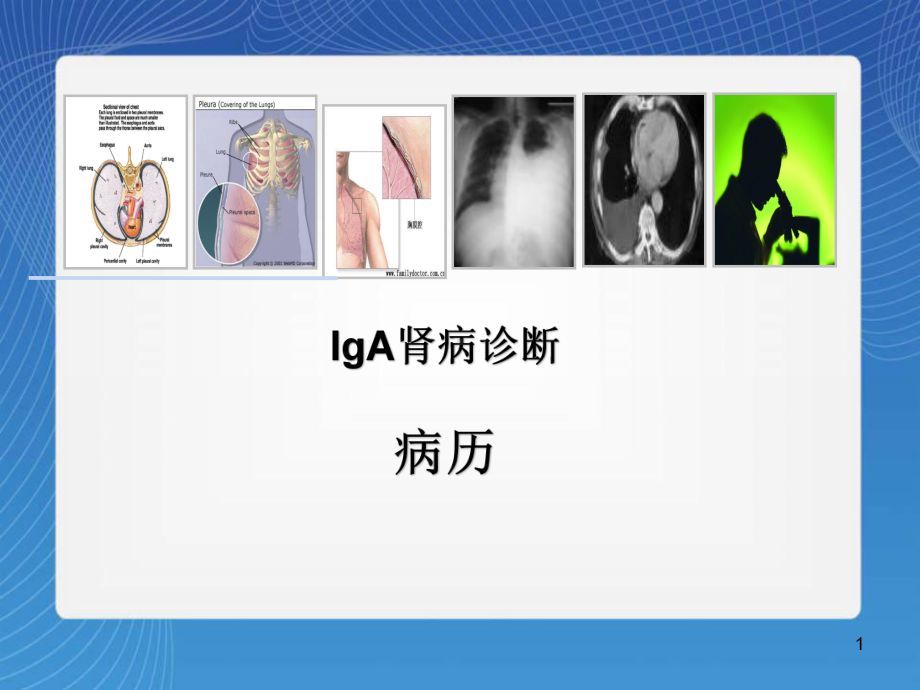 医学课件-IgA肾病诊断课件.ppt_第1页