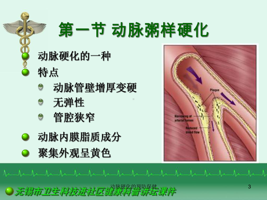 动脉硬化的预防保健课件.ppt_第3页