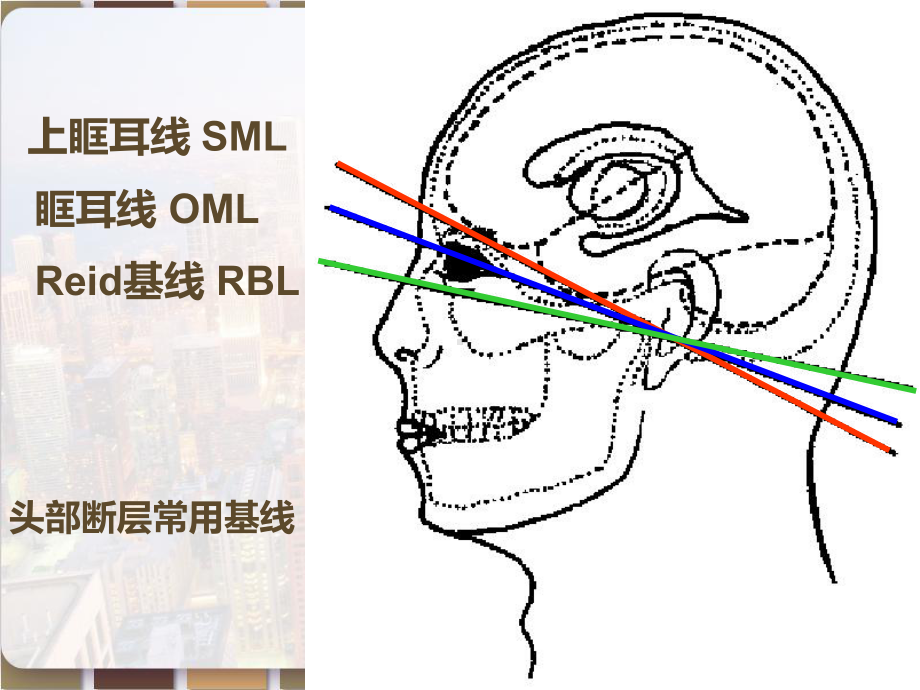 头颅CT解剖及诊断-课件.pptx_第3页