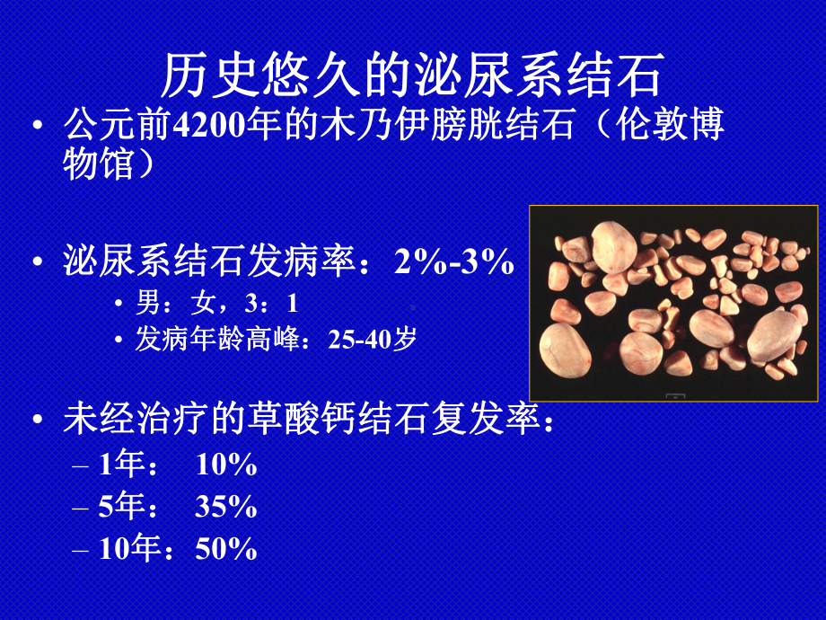 医学泌尿系结石医学知识宣讲培训课件.ppt_第3页