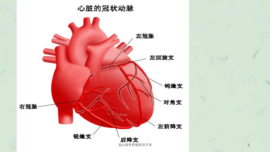 冠心病外科现状及手术课件.ppt_第3页