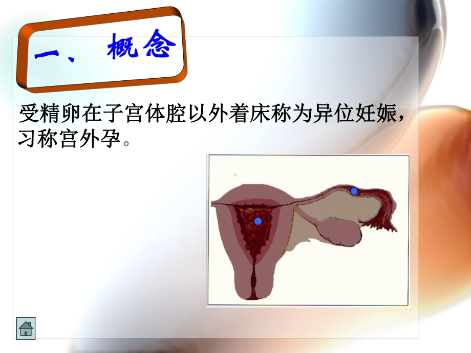 宫外孕医学知识专题讲座培训课件.ppt_第3页