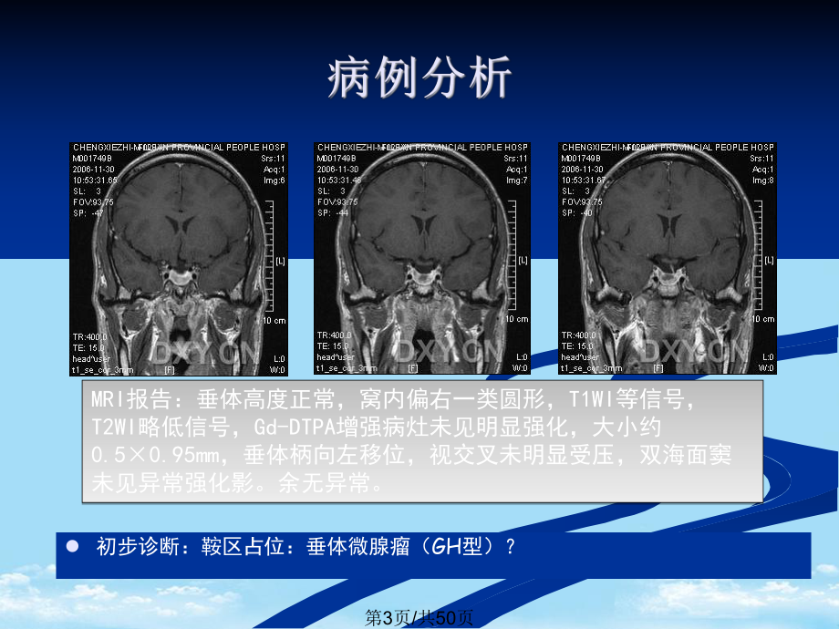 垂体瘤全面版课件.pptx_第3页