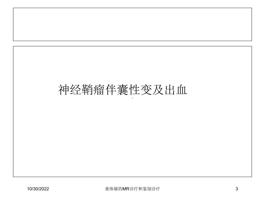 垂体瘤的MR诊疗和鉴别诊疗课件.ppt_第3页