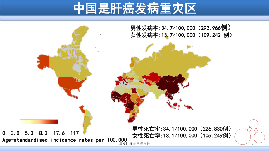 原发性肝癌-医学宣教培训课件.ppt_第2页