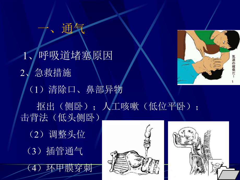 创伤现场急救技术培训课件.ppt_第2页