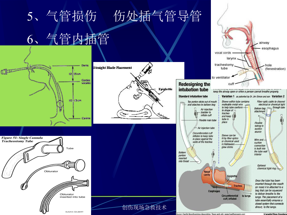 创伤现场急救技术培训课件.ppt_第3页