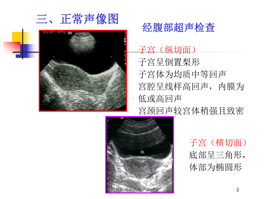 妇产科疾病的超声诊疗培训课件.ppt_第2页