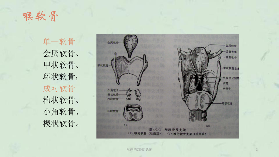 喉癌的CTMRI诊断课件.ppt_第3页