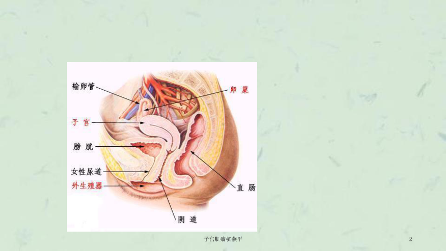 子宫肌瘤杭燕平课件.ppt_第2页