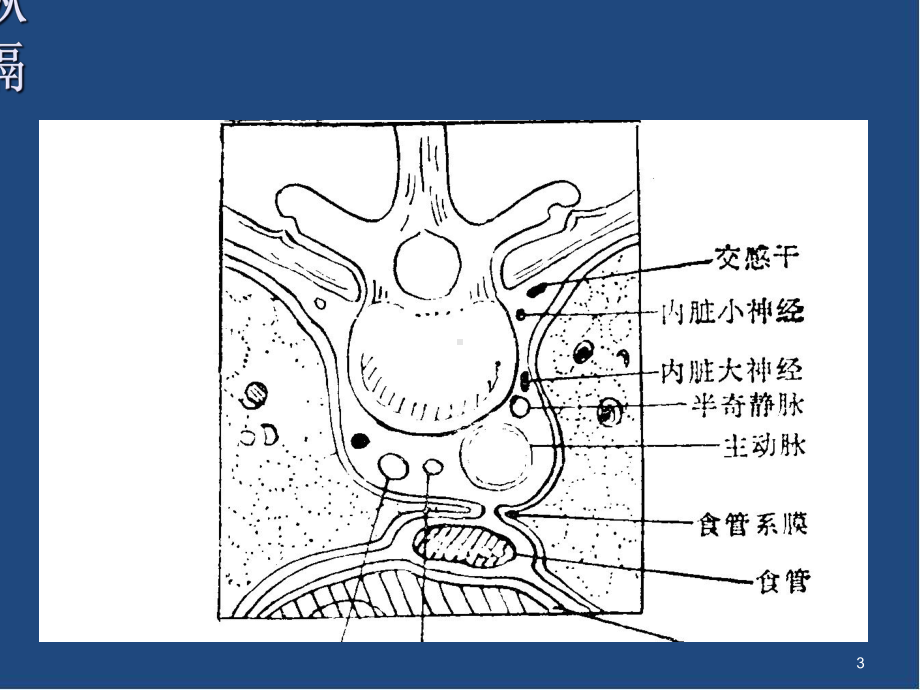 后纵隔肿瘤影像表现教学课件.ppt_第3页