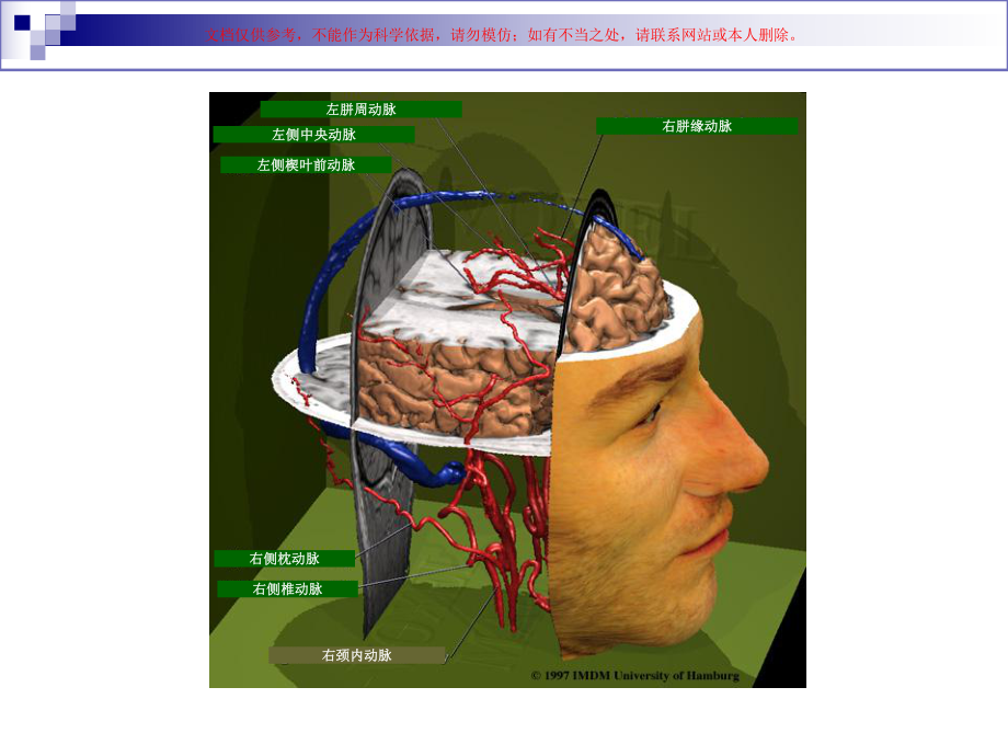 人脑和脑血管解剖分析培训课件.ppt_第1页