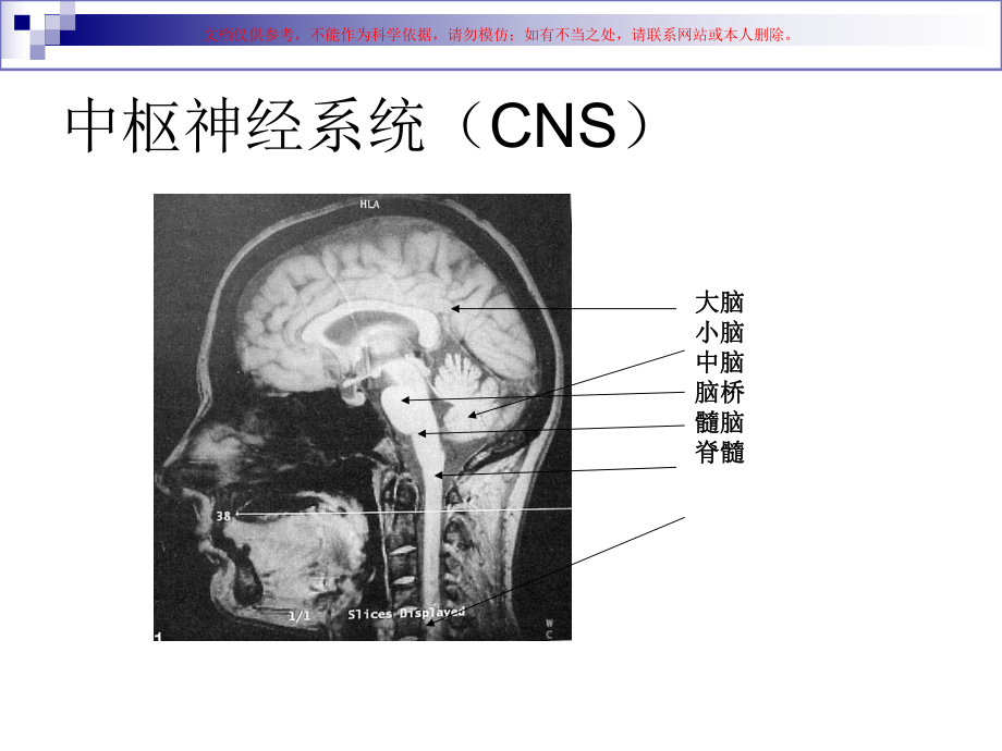 人脑和脑血管解剖分析培训课件.ppt_第2页