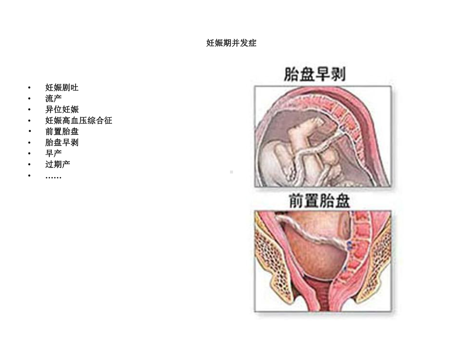 妊娠合并症并发症处理课件.ppt_第2页