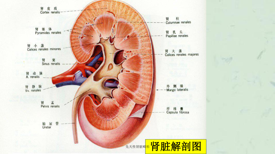 先天性肾脏畸形课件.ppt_第3页