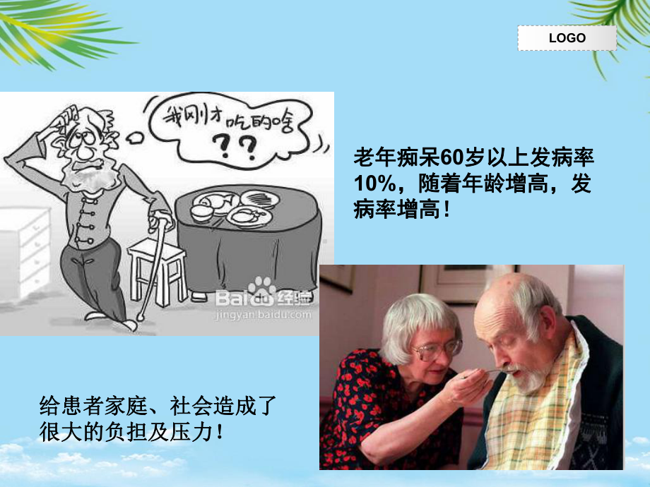 可以治疗的痴呆正压性脑积水课件.ppt_第2页