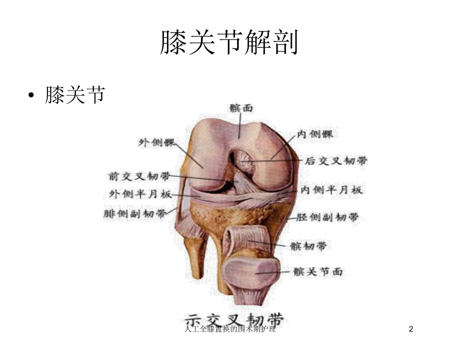 人工全膝置换的围术期护理培训课件.ppt_第2页