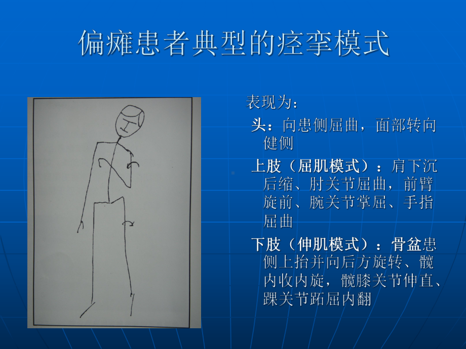 医学课件良肢位摆放专题宣讲.ppt_第2页