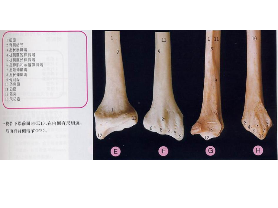 医学课件桡骨茎突部狭窄性腱鞘炎.ppt_第3页