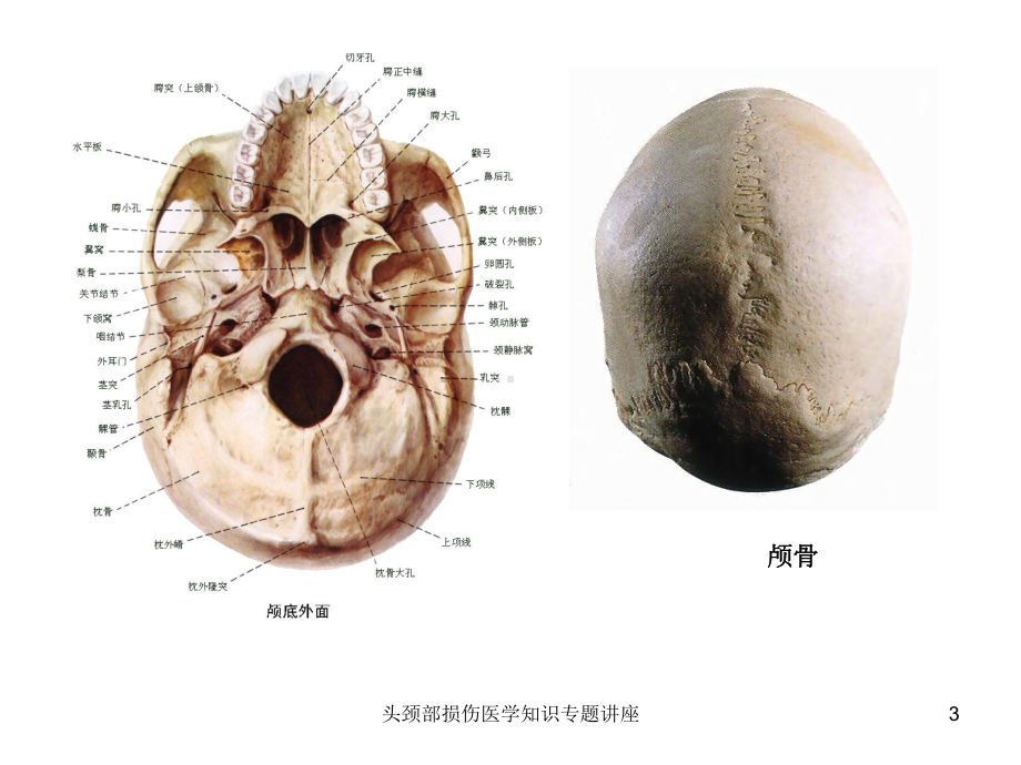 头颈部损伤医学知识专题讲座培训课件.ppt_第3页