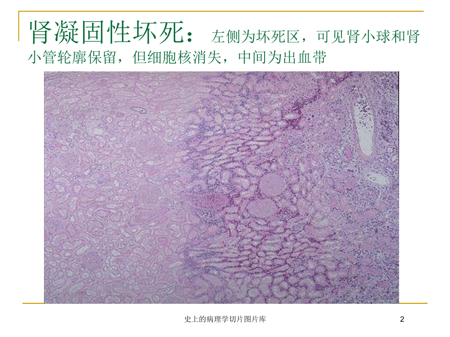 史上的病理学切片图片库培训课件.ppt_第2页