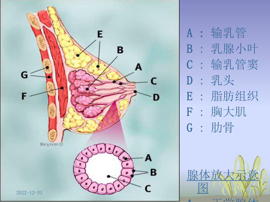 乳腺钙化课件.pptx_第2页