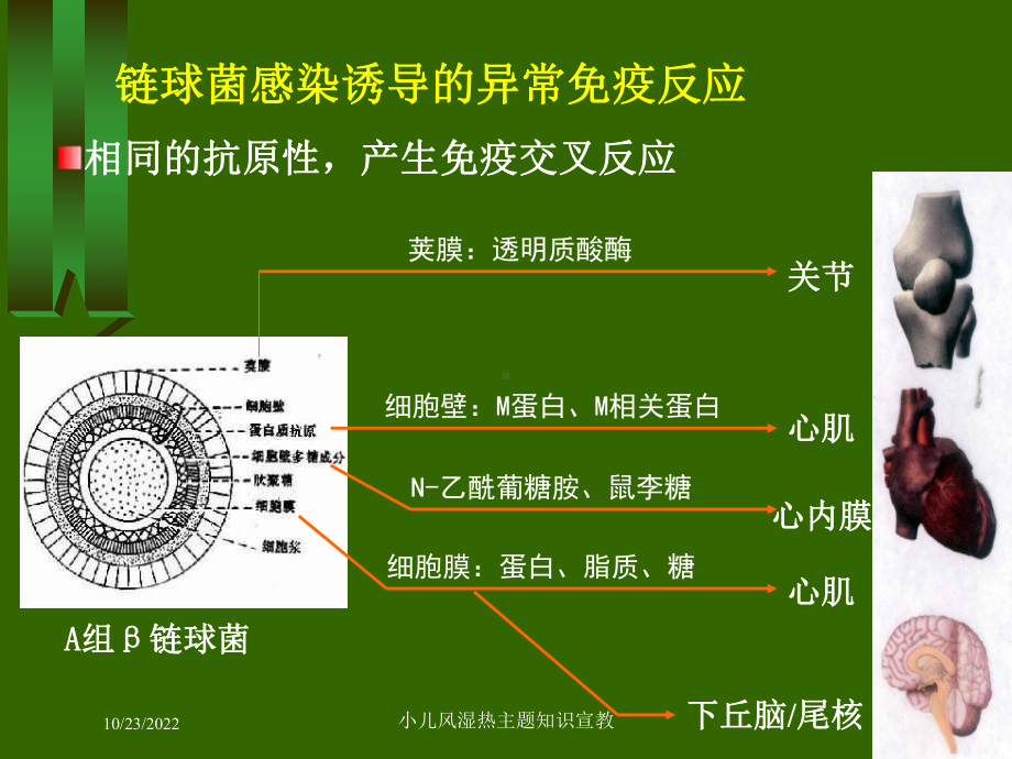 小儿风湿热主题知识宣教课件.ppt_第3页