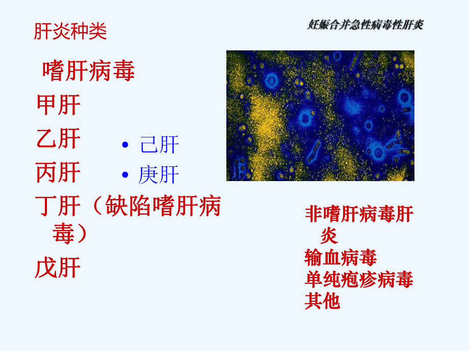 妊娠合并肝病课件.ppt_第2页