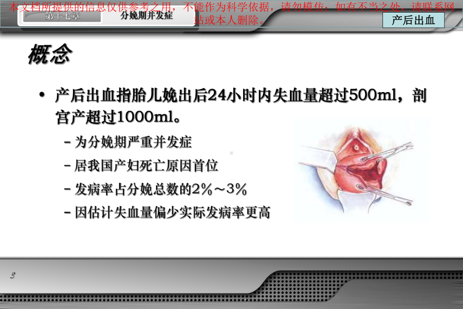 产后出血医学知识宣讲培训课件.ppt_第3页