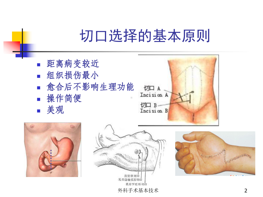 外科手术基本技术培训课件.ppt_第2页