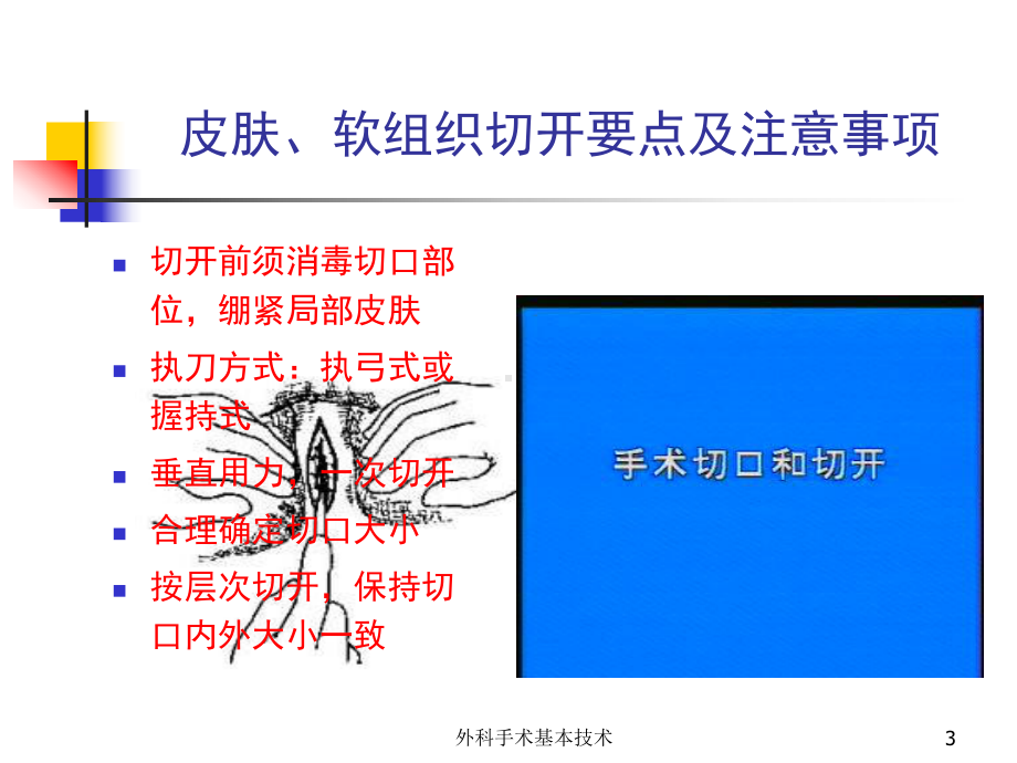 外科手术基本技术培训课件.ppt_第3页