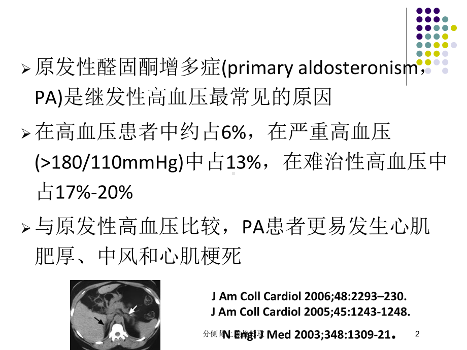 分侧肾上腺静脉取培训课件.ppt_第2页