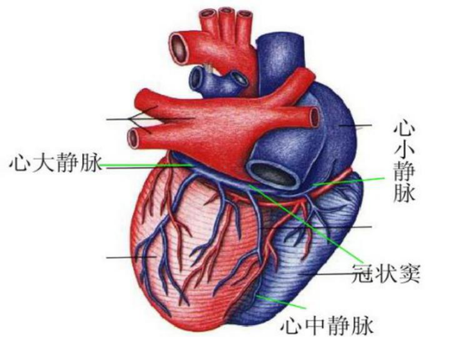 冠状静脉窦无顶综合征课件.ppt_第3页