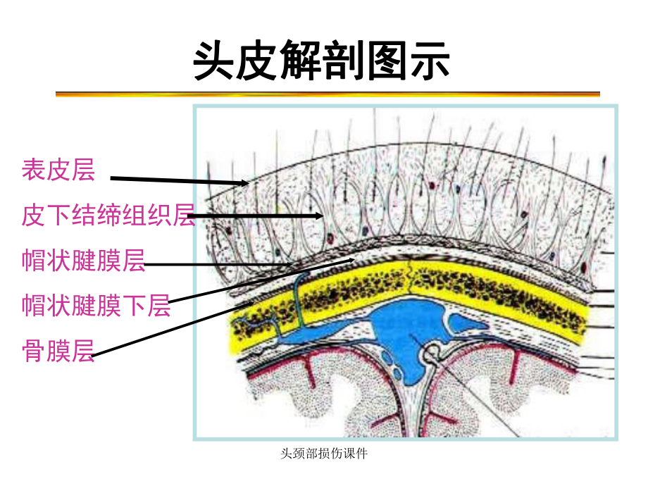 头颈部损伤课件.ppt_第2页