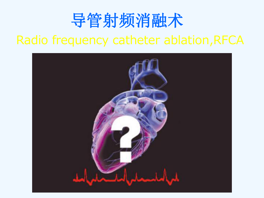 射频消融患者围手术期的护理课件.ppt_第3页