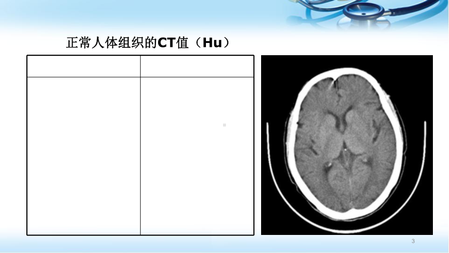 头颅CT基本知识及神经外科常见疾病CT读片教学课件.ppt_第3页