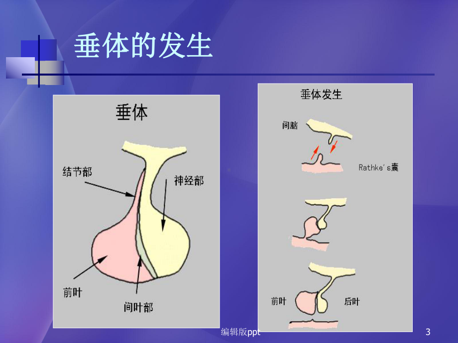 儿童鞍区常见肿瘤的影像学诊断课件.ppt_第3页