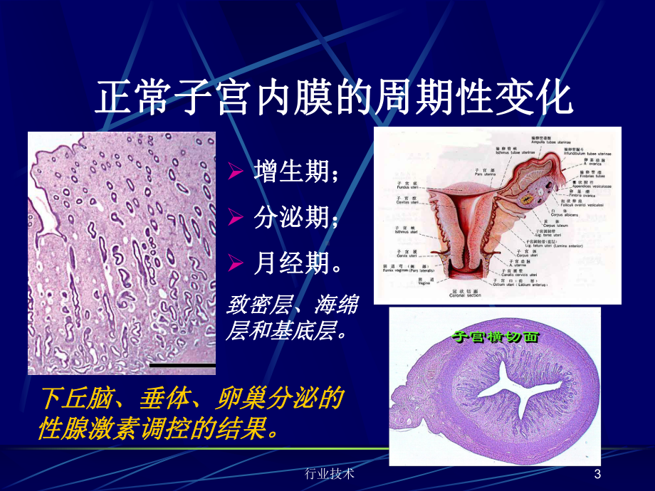 子宫内膜和乳腺疾病(专业技术)课件.ppt_第3页