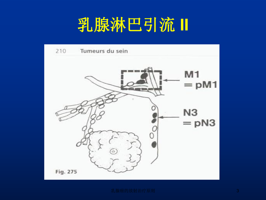 乳腺癌的放射治疗原则培训课件.ppt_第3页