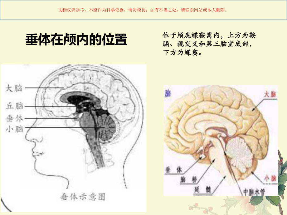 垂体瘤专题宣讲课件.ppt_第2页