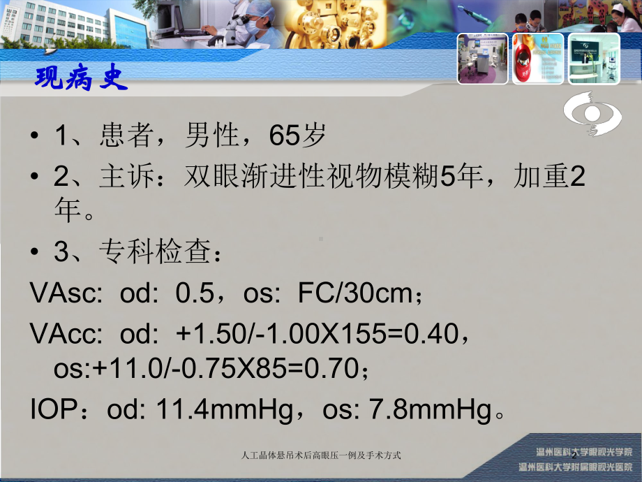 人工晶体悬吊术后高眼压一例及手术方式培训课件.ppt_第2页