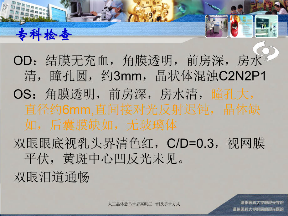 人工晶体悬吊术后高眼压一例及手术方式培训课件.ppt_第3页