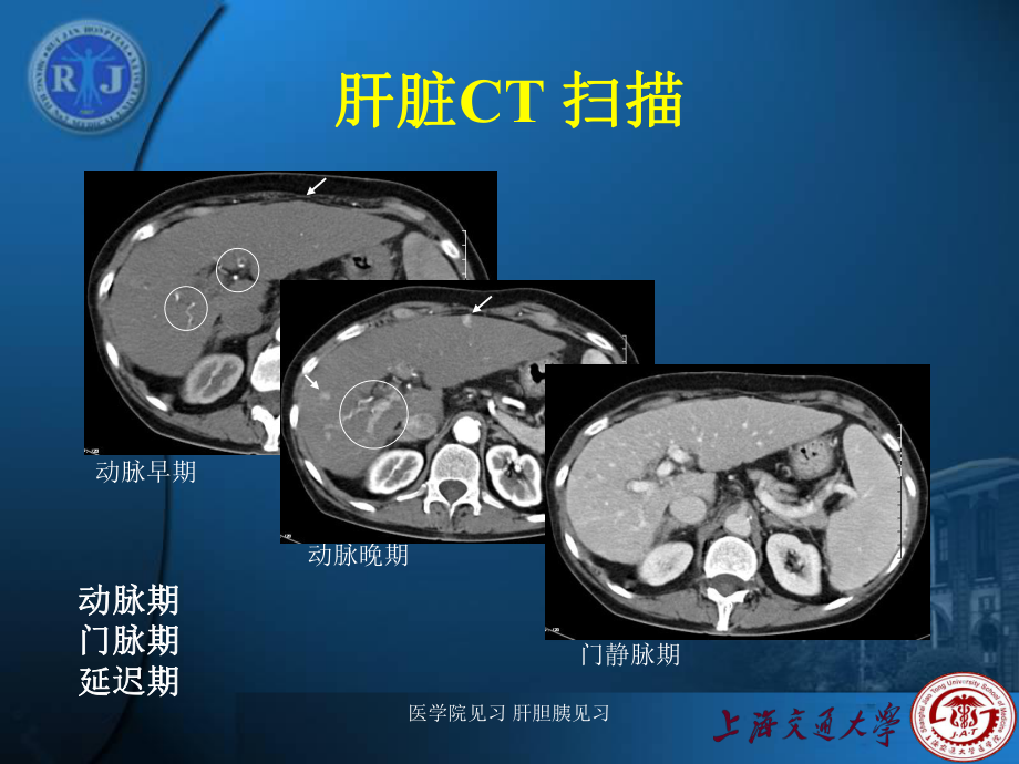 医学院见习-肝胆胰见习课件.ppt_第3页